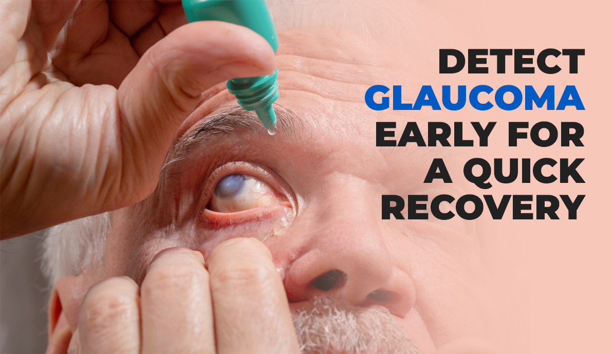 Detect Glaucoma Early for a Quick Recovery