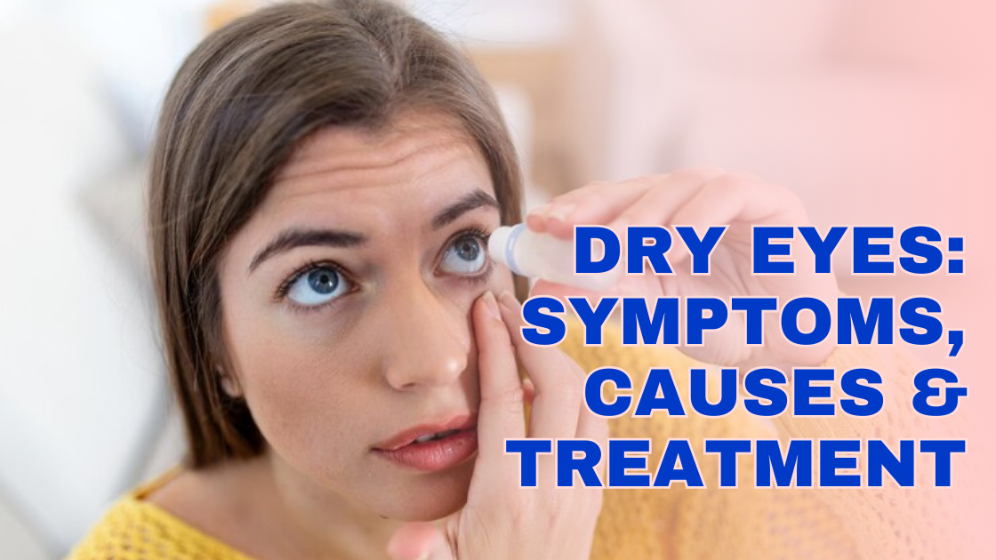 Dry Eyes: Symptoms, Causes & Treatment