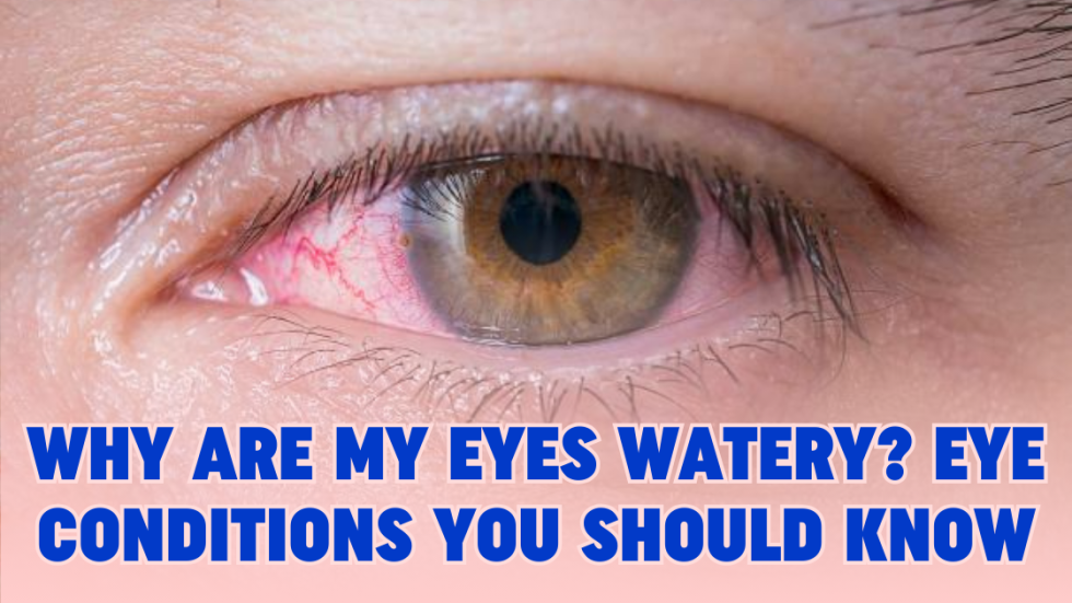 why-are-my-eyes-watering-you-should-know-about-eye-condition