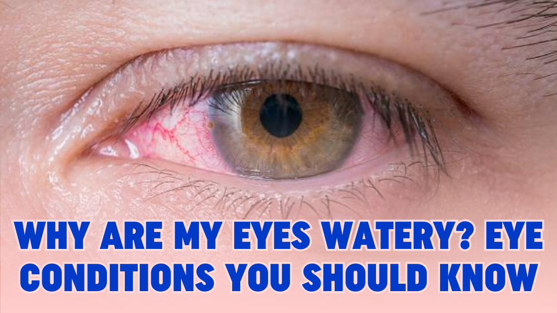 Why are my eyes watering? You Should Know about Eye Condition