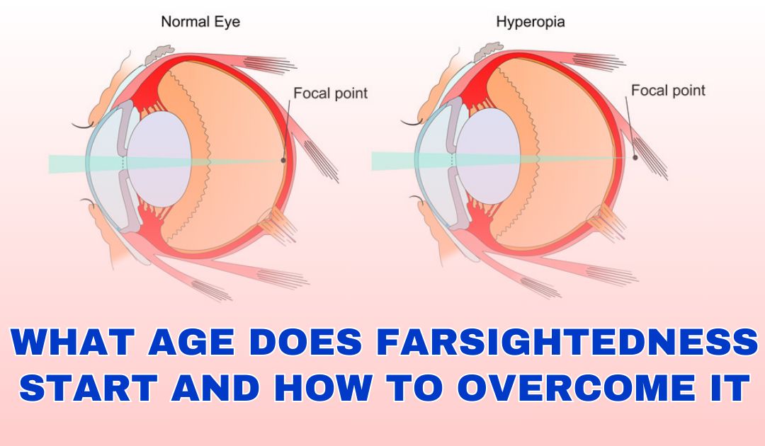 What Age Does Farsightedness Start & How To Overcome It?