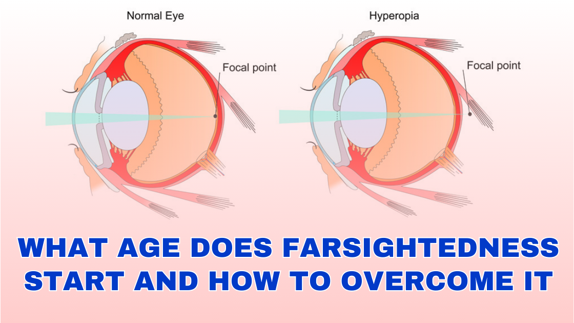 What Age Does Farsightedness Start & How To Overcome It?